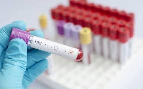 HIV Testing